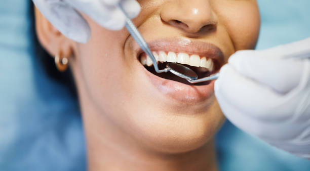 Best Broken or Cracked Tooth Emergency Dentist in Spring City, PA